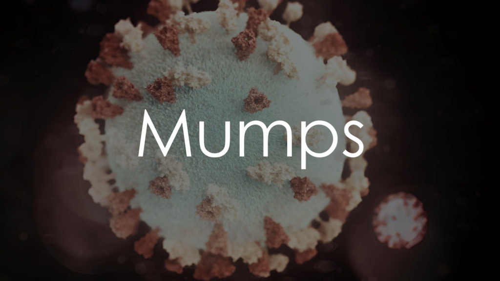 Mumps