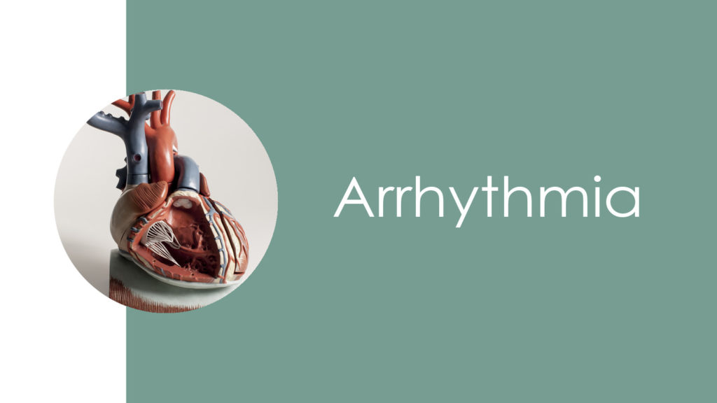 Arrhythmia2