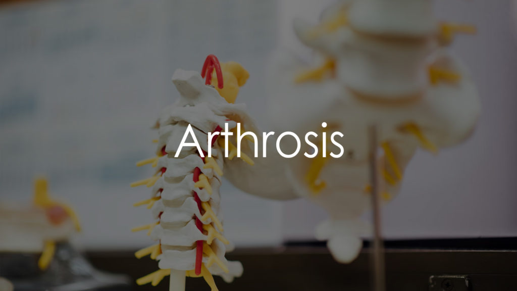 Arthrosis