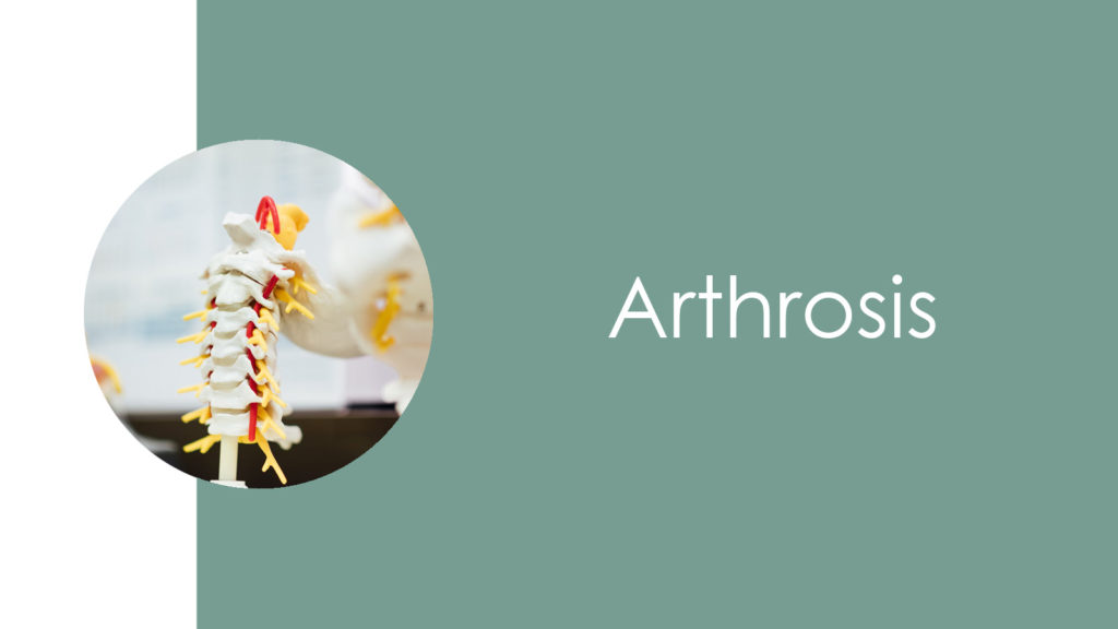 Arthrosis2