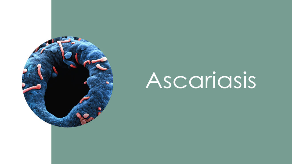 Ascariasis2