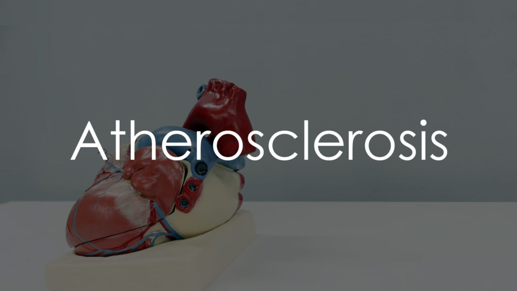 Atherosclerosis