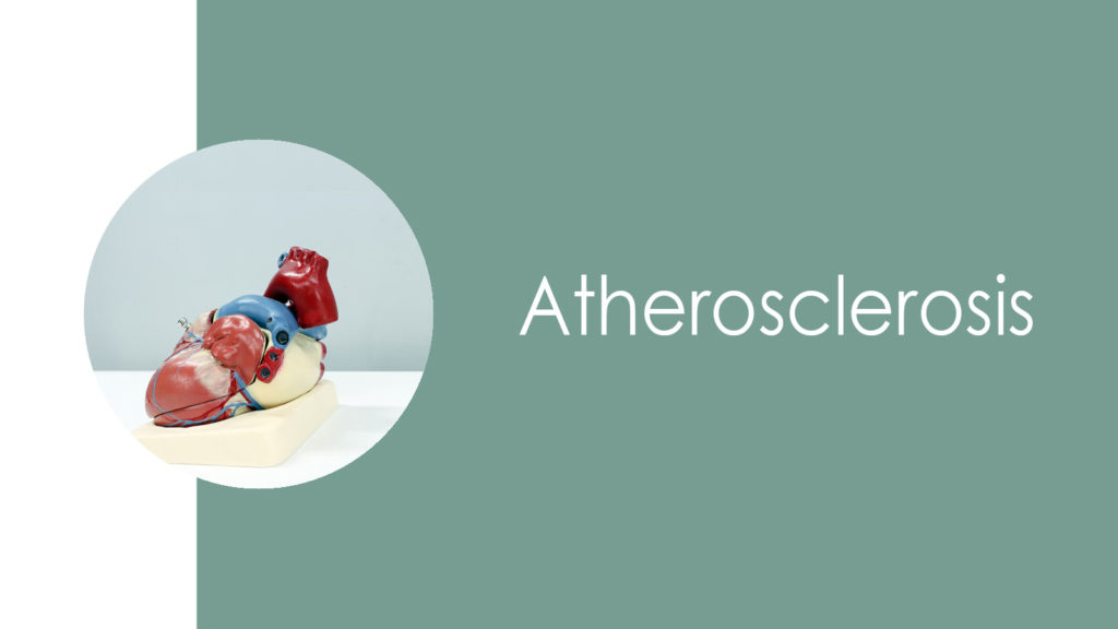 Atherosclerosis2