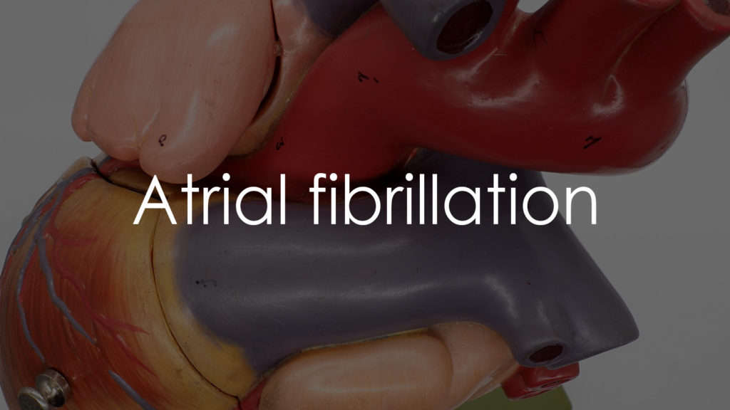 Atrial fibrillation