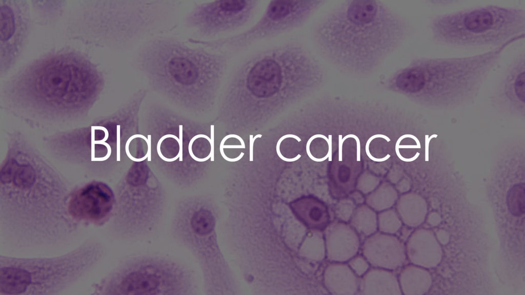 Bladder cancer