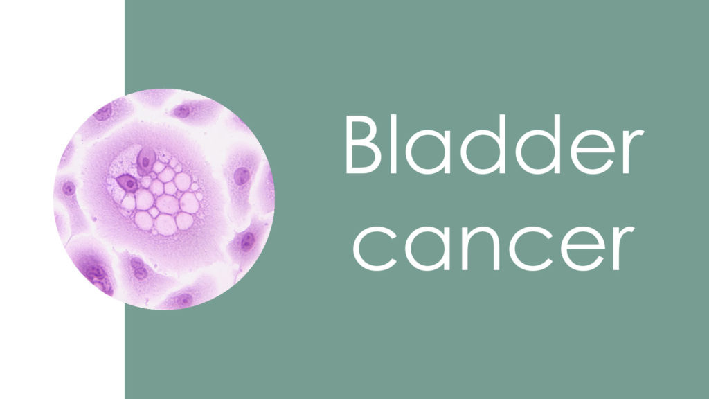 Bladder cancer3