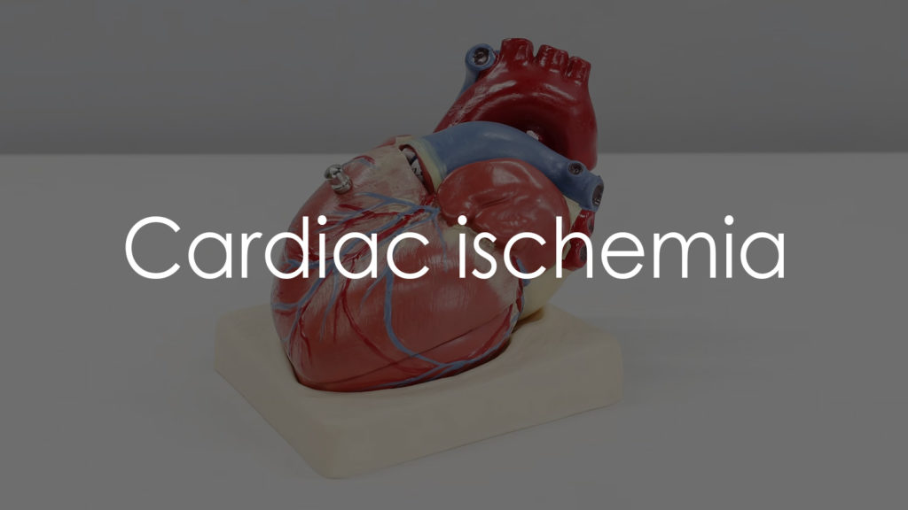 Cardiac ischemia