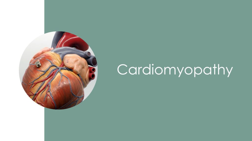 Cardiomyopathy