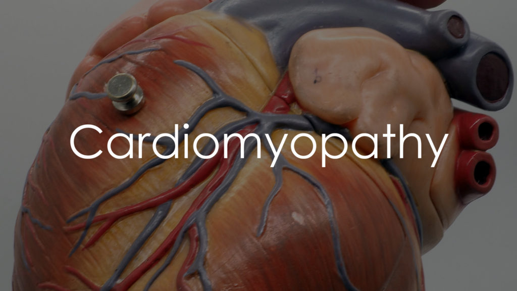 Cardiomyopathy2