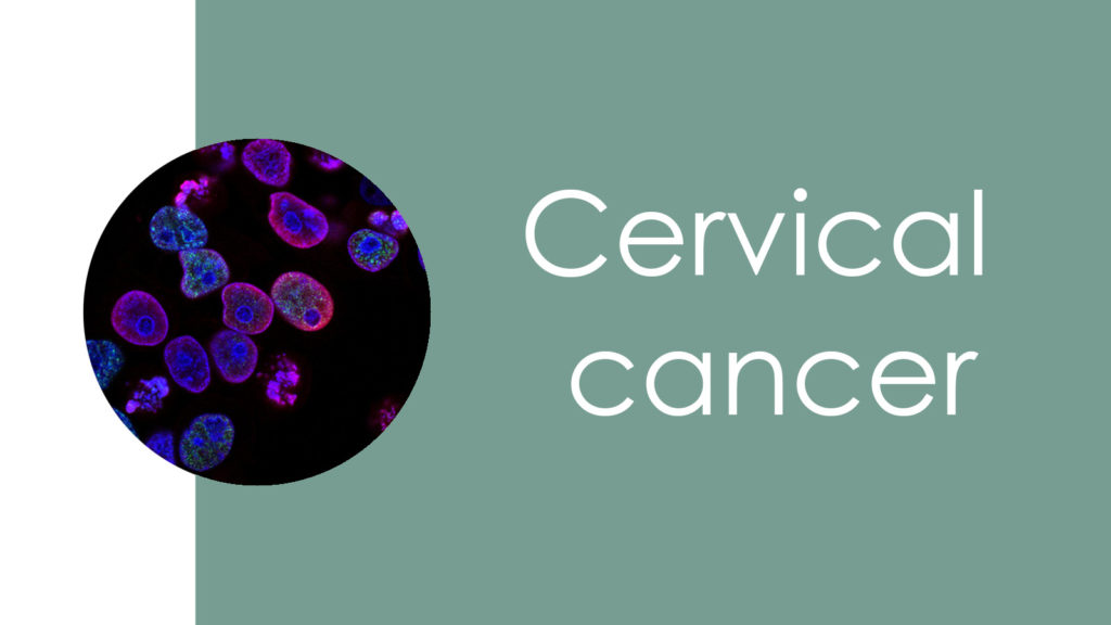 Cervical cancer3