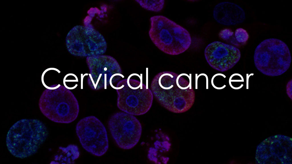 Cervical cancer