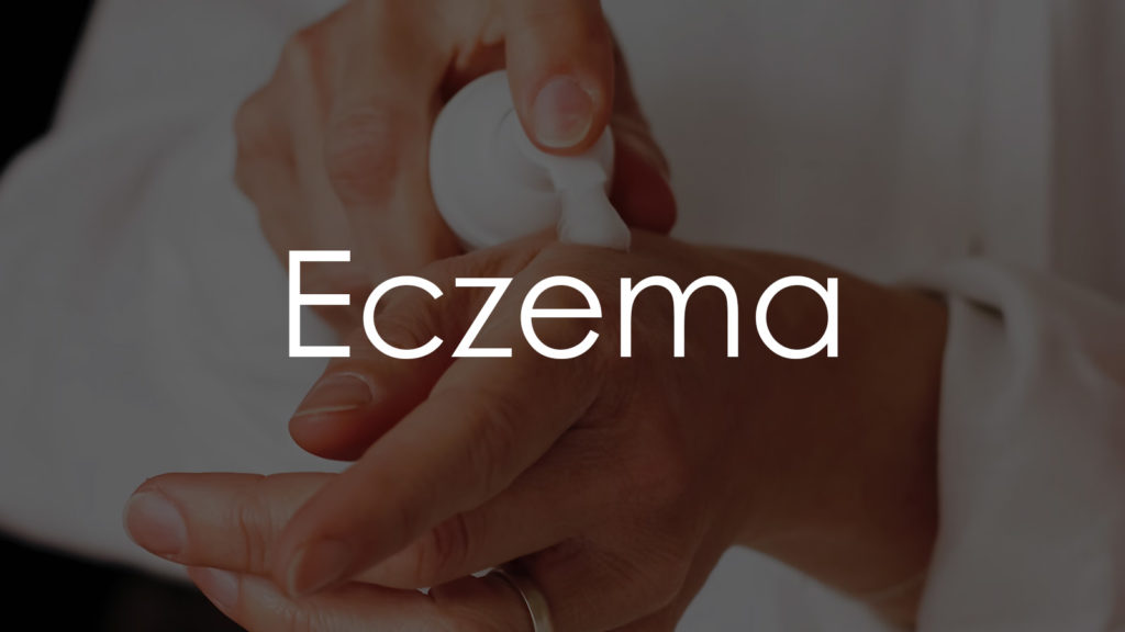 Eczema