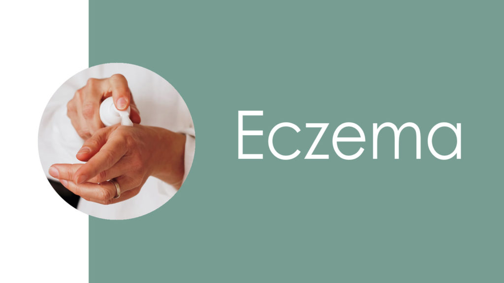 Eczema2