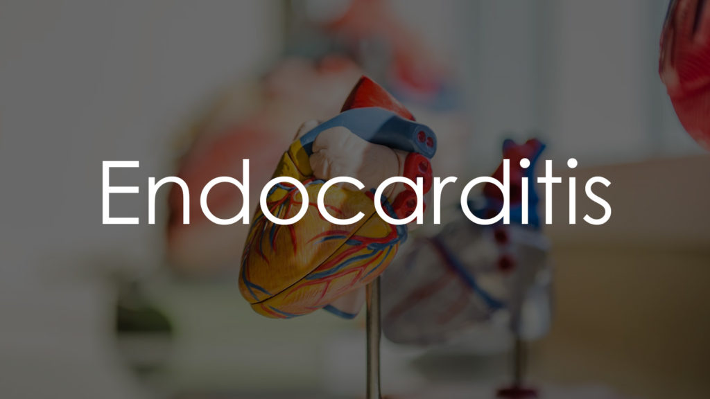 Endocarditis