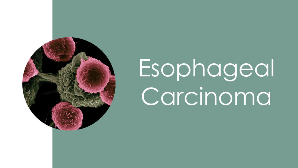 Esophageal Carcinoma3