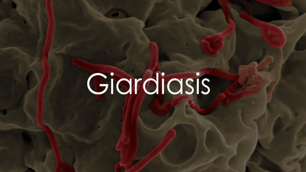 Giardiasis