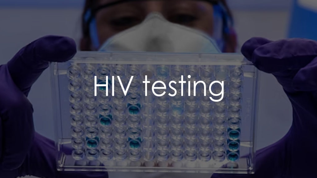 HIV testing