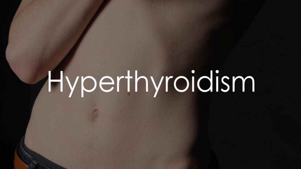 Hyperthyroidism