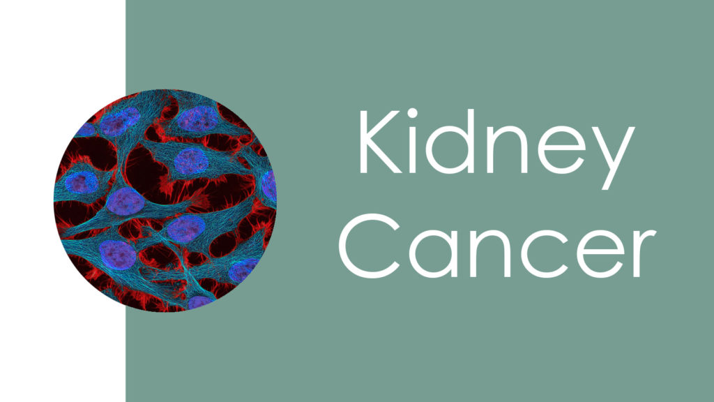 Kidney Cancer3