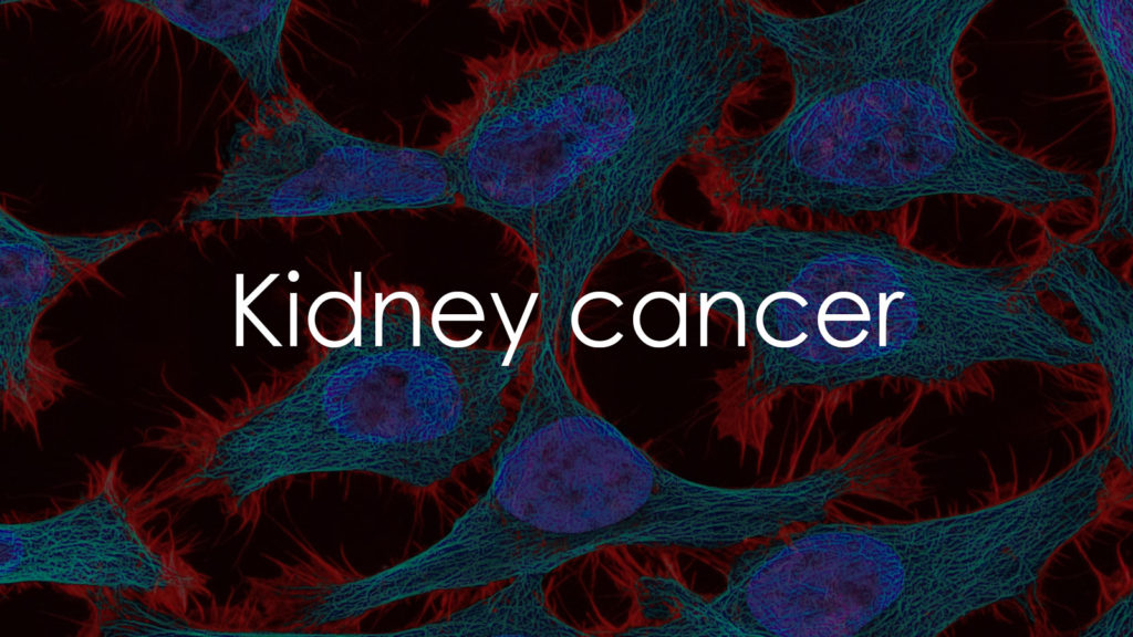 Kidney cancer