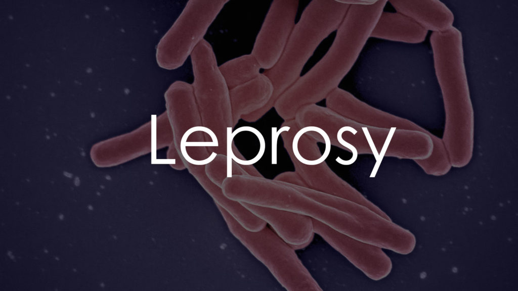 Leprosy