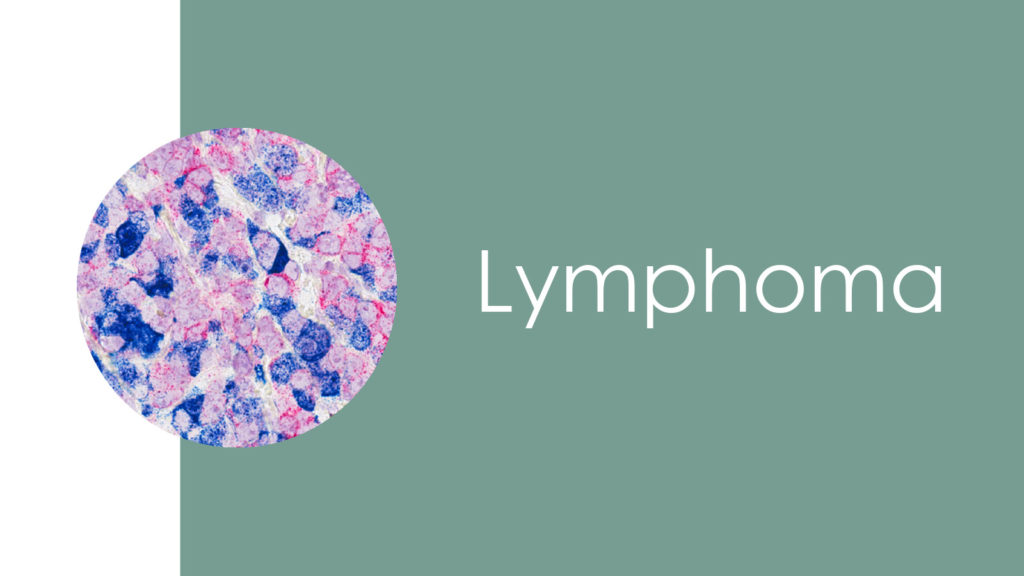 Lymphoma2