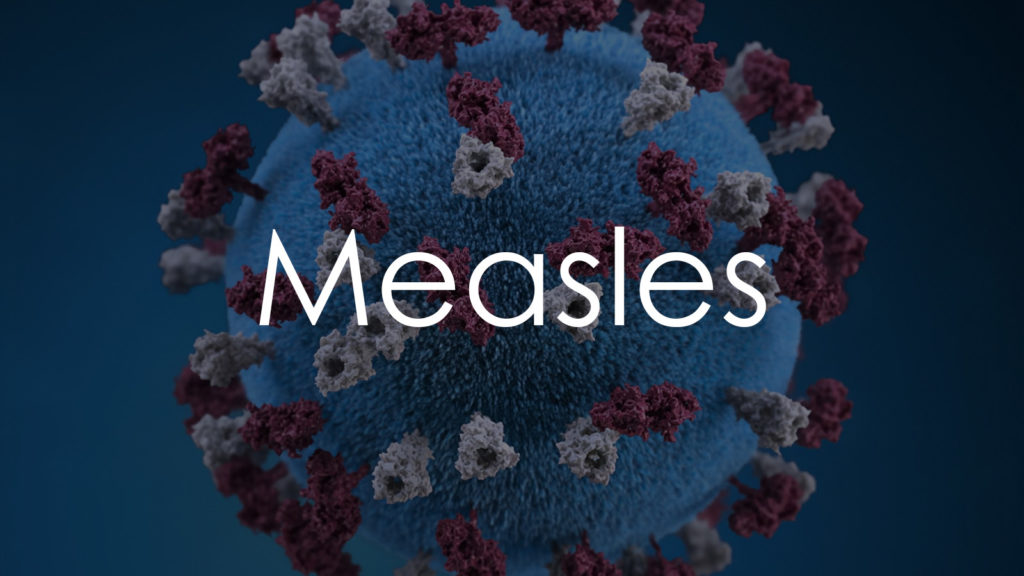 Measles