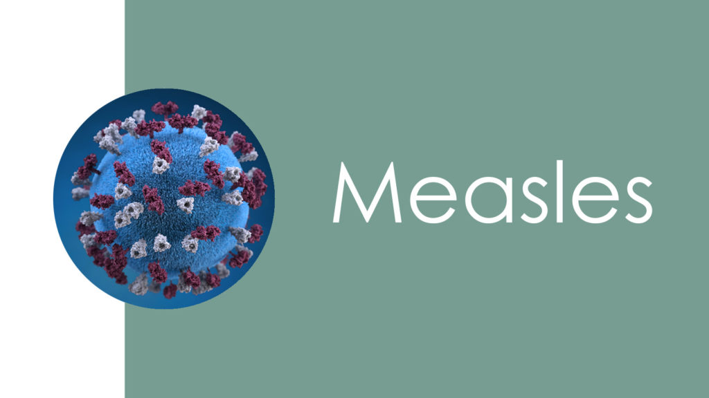 Measles 2