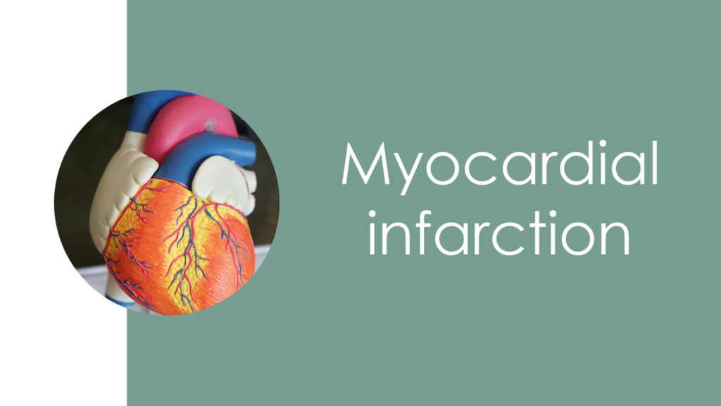 Myocardial infarction2