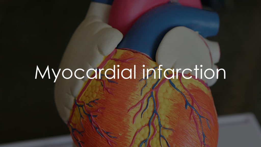 Myocardial infarction2