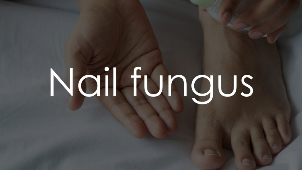 Nail fungus2