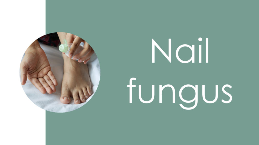 Nail fungus4