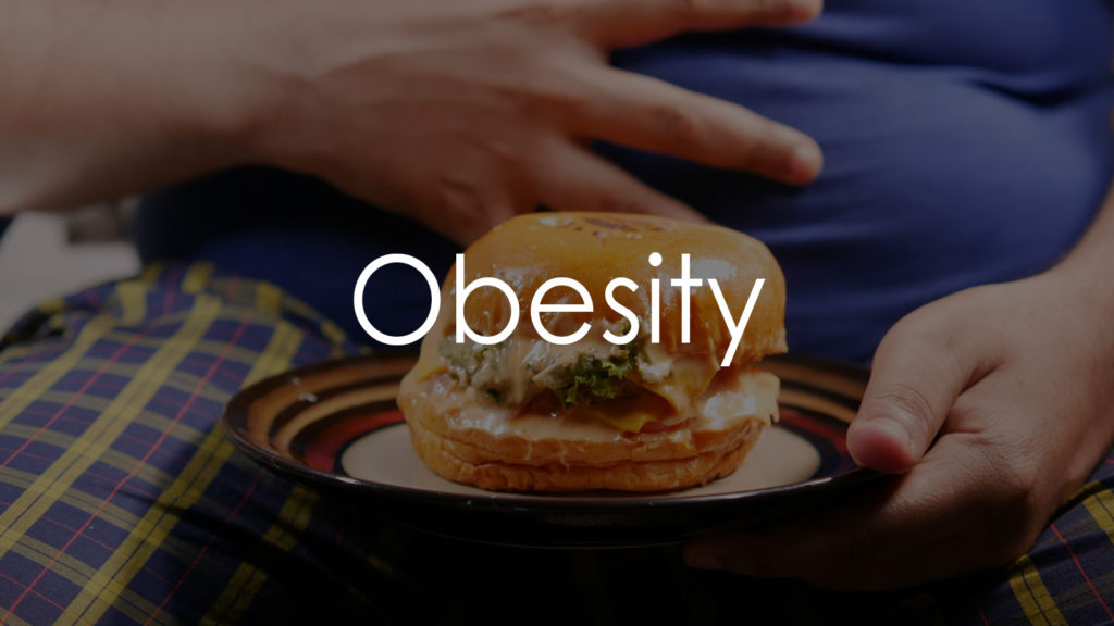 Obesity