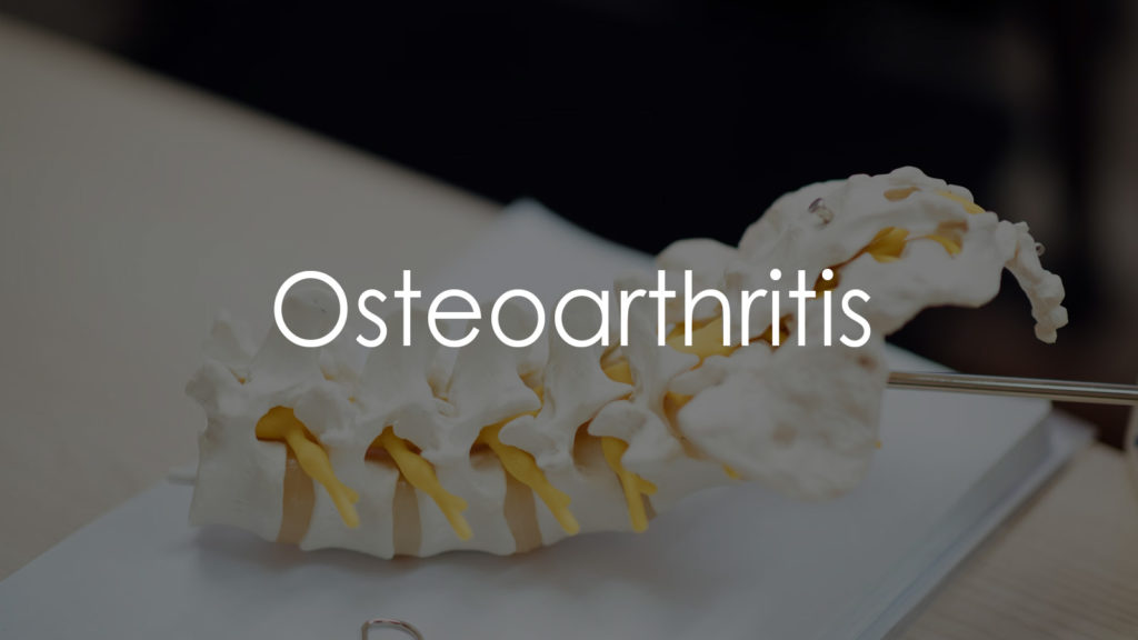 Osteoarthritis