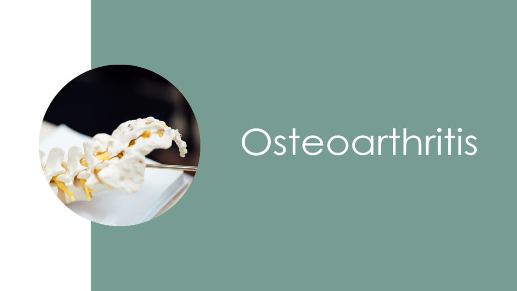 Osteoarthritis3