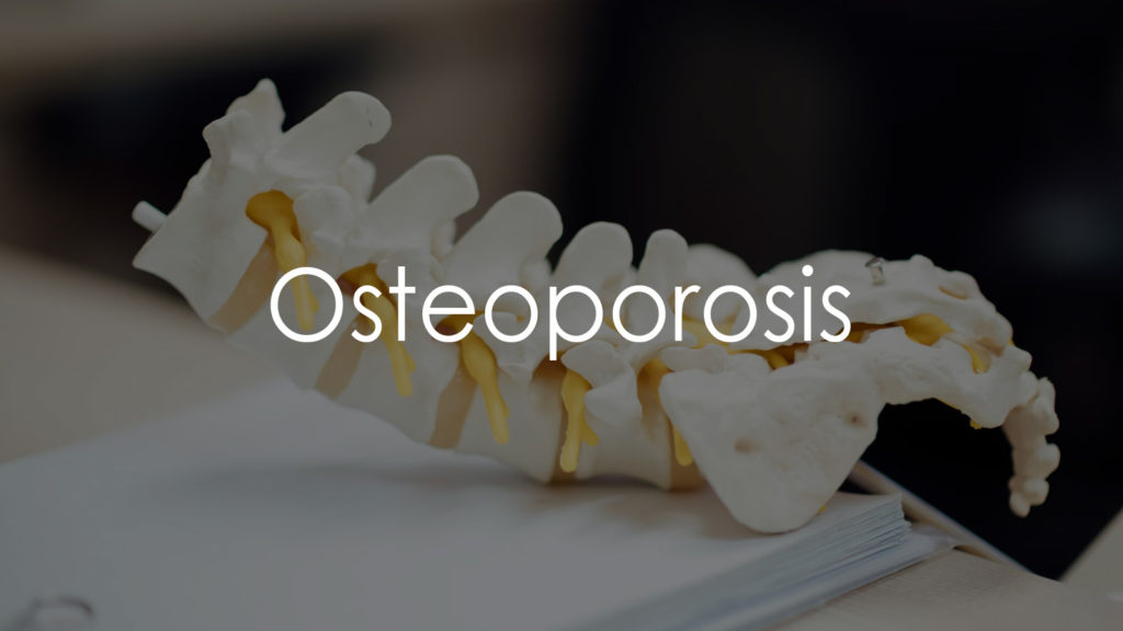 Osteoporosis