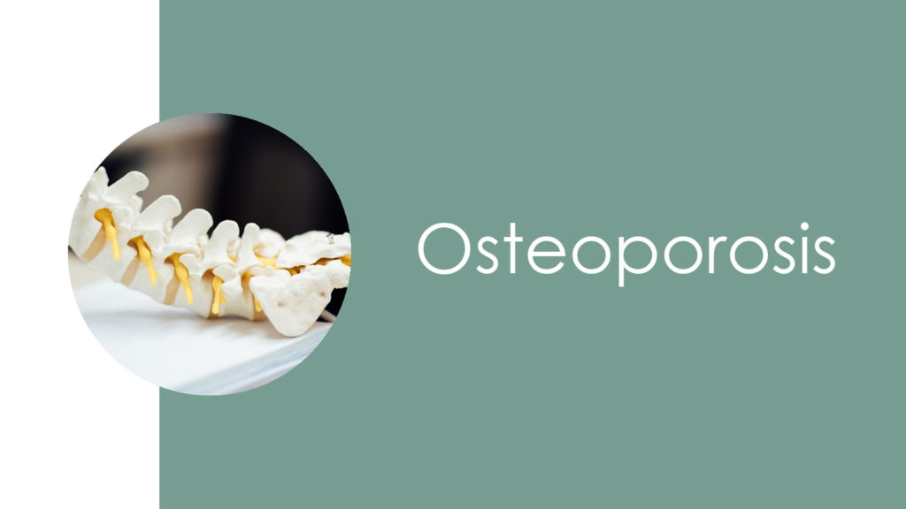 Osteoporosis2