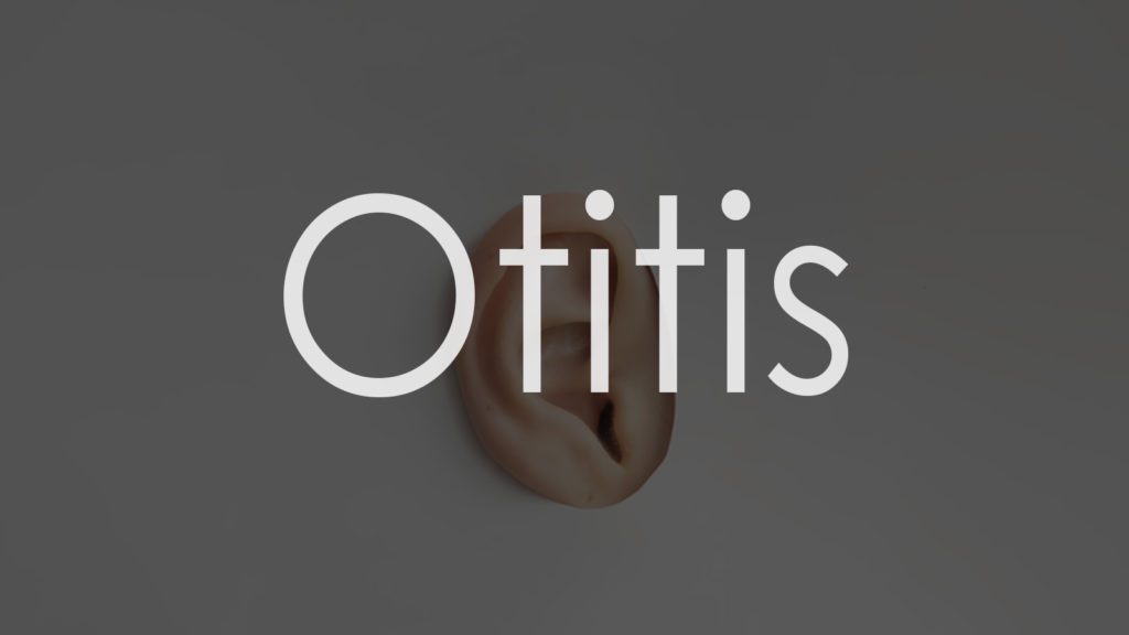 Otitis6