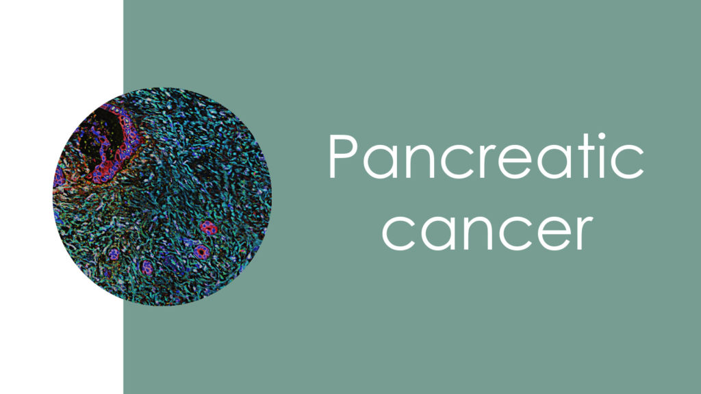 Pancreatic cancer4