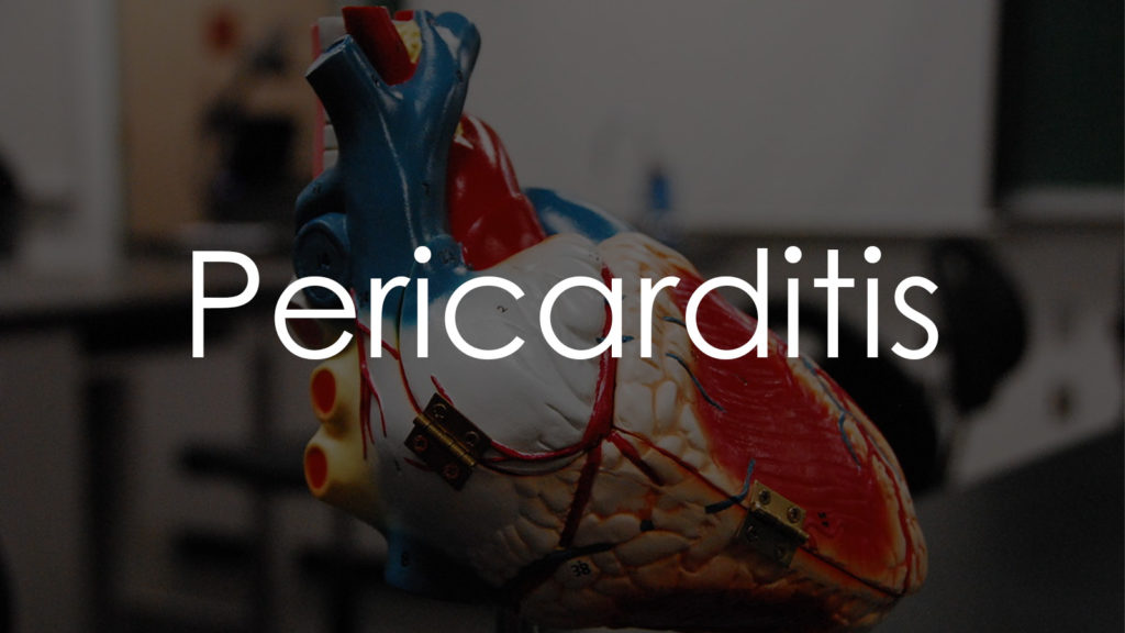 Pericarditis