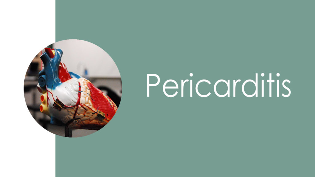 Pericarditis2