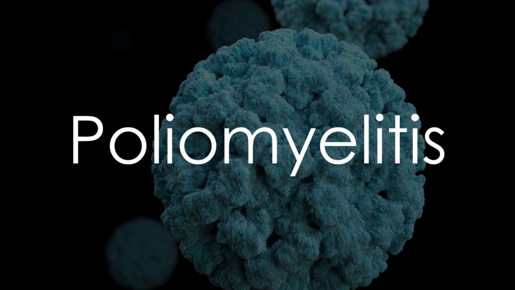 Poliomyelitis