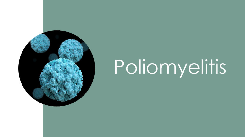 Poliomyelitis 2