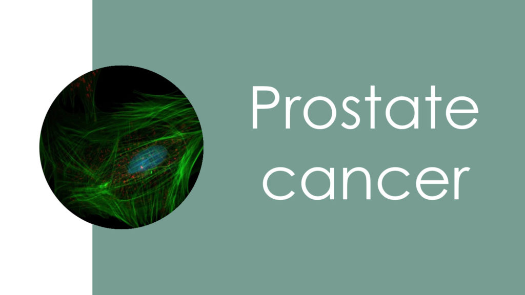 Prostate cancer3