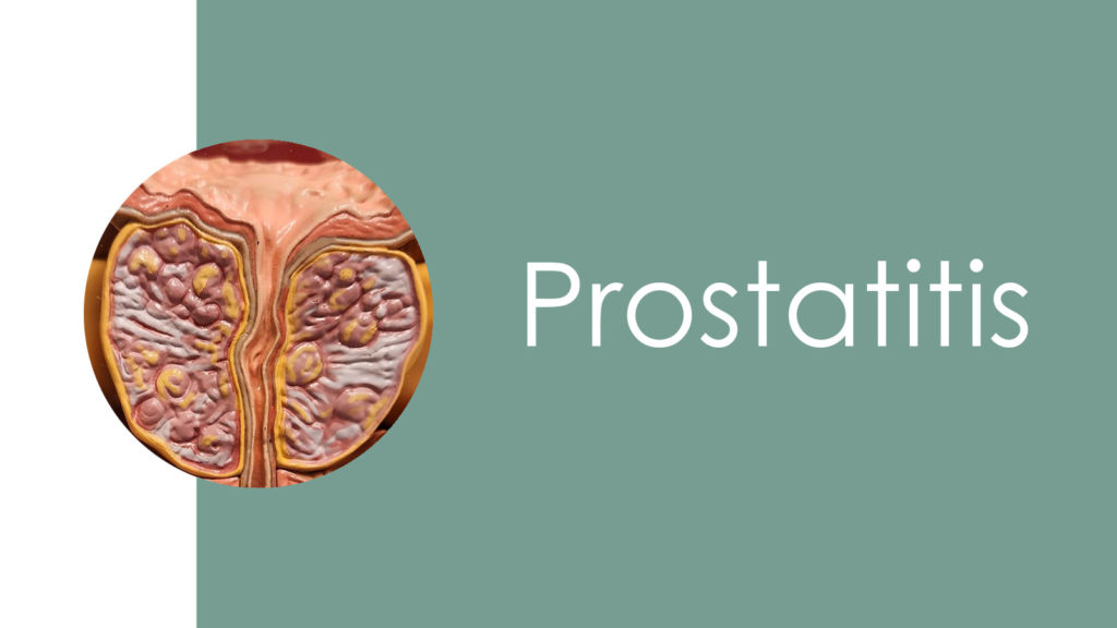 Prostatitis 2