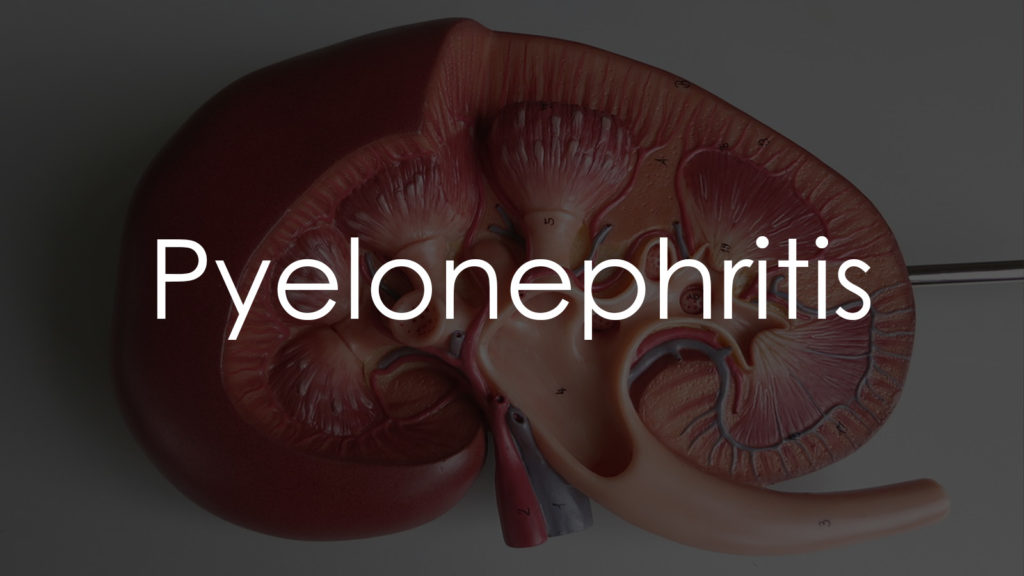 Pyelonephritis