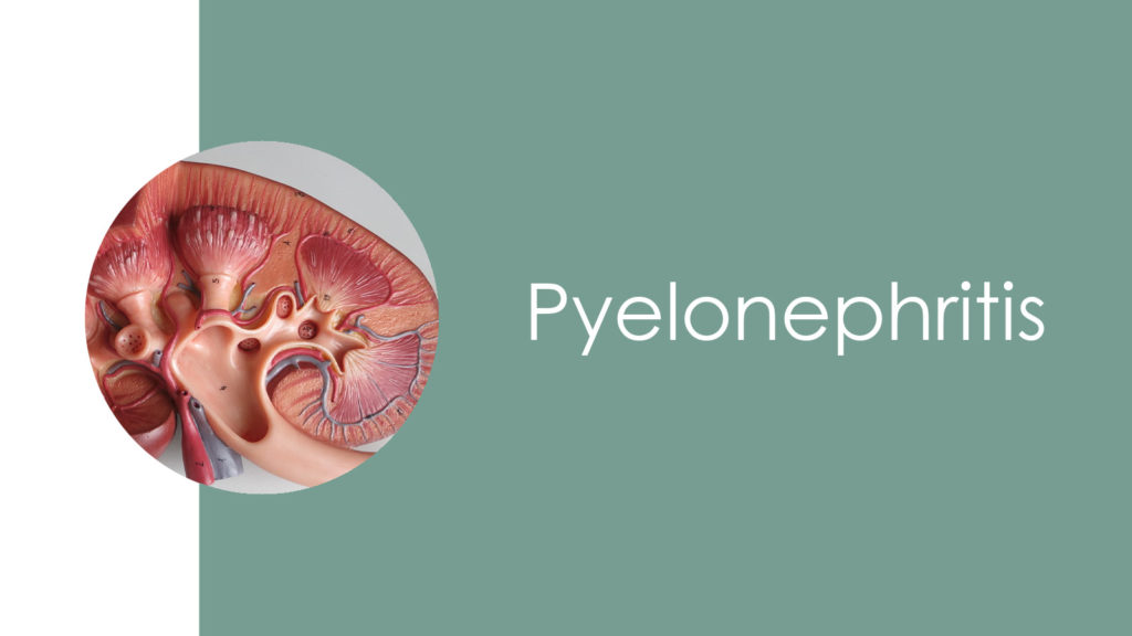 Pyelonephritis 2