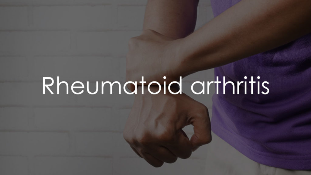 Rheumatoid arthritis