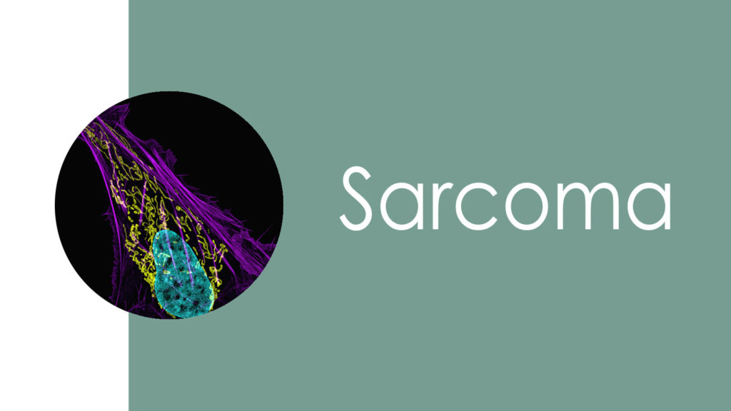 Sarcoma 2