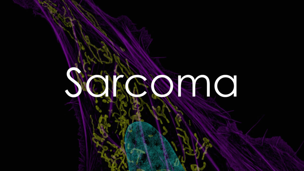 Sarcoma2